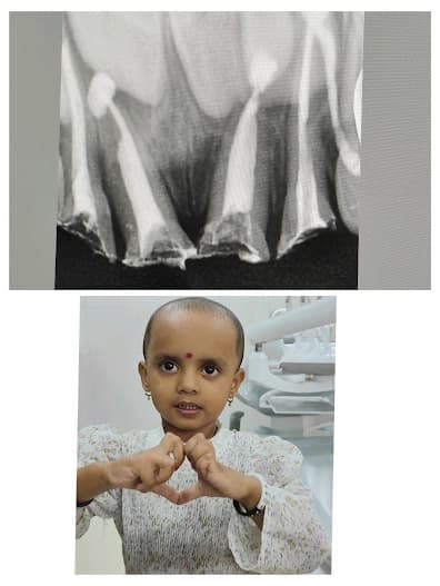 Happy Patients