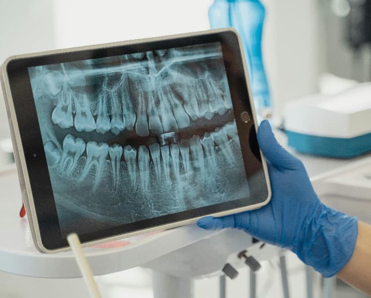 Digital X Ray